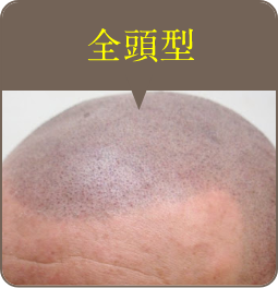 全頭型