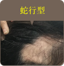 蛇行型