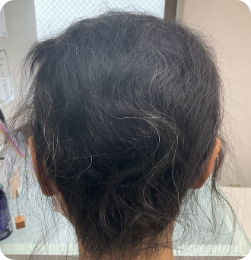 50代女性の事例 After