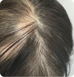 50代女性の事例 Before