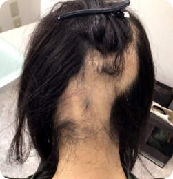 40代女性の事例 Before
