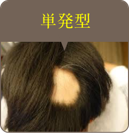 単発型
