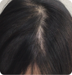 50代女性の事例 After