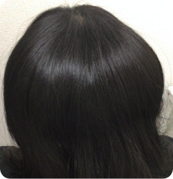 10代女性の事例 After
