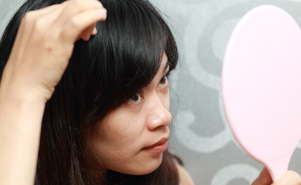 円形脱毛症も対応